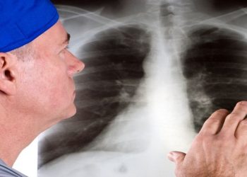 Asbest temasıyla akciğer zarı kanserine neden olan gen bulundu