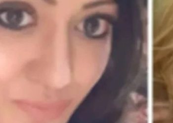 Feci olay… Yumurta bomba üzere yüzüne patladı! Son halini paylaşan bayanın yüzünde feci halde yanıklar oluştu: İşte son hali