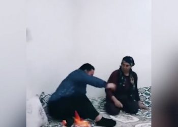 TikTok için elini yaktı!