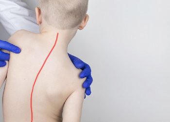 Skolyoz Tedavisinde Gerçek Sanılan 7 Yanlışa Dikkat!