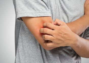 Mantar Hastalığı Hakkında Bilinmesi Gereken 6 Kıymetli Bilgi!