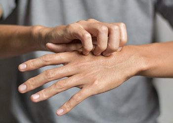 Uyuz olaylarında artış !