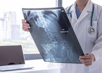 Kanser Önlenebilir Bir Hastalıktır!