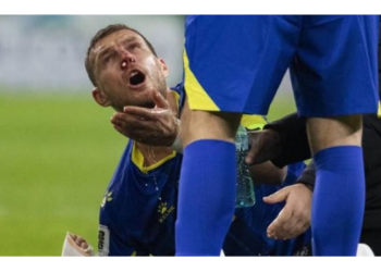 Edin Dzeko’nun, Romanya maçında burnu kırıldı
